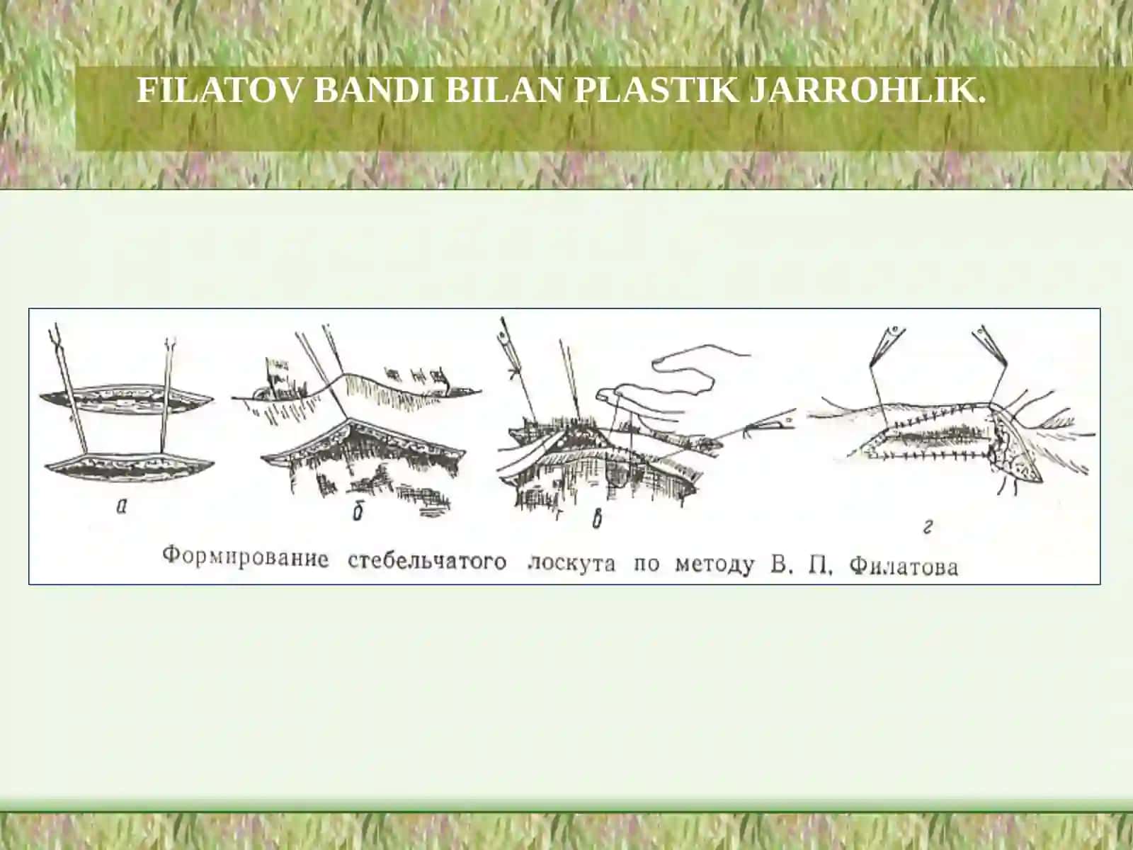FILATOV BANDIBILAN PLASTIK JARROHLIK 3
