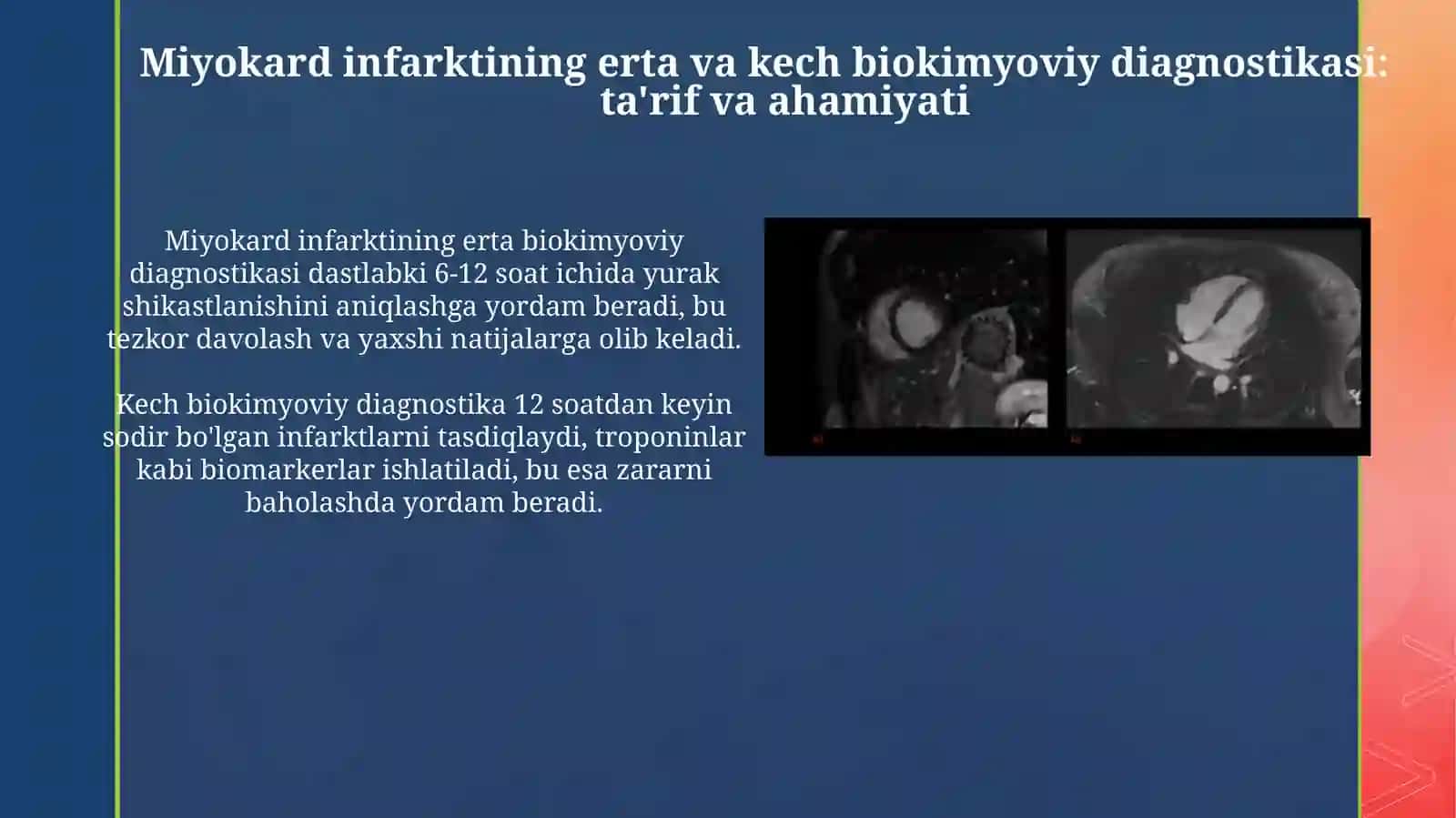 Miokard infarktining erta va kech biokimyoviytashxisi 3