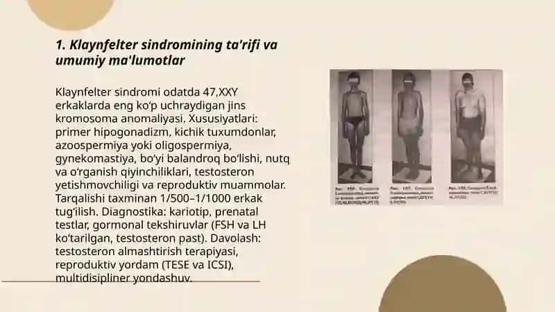 Klaynfelter sindromi 3