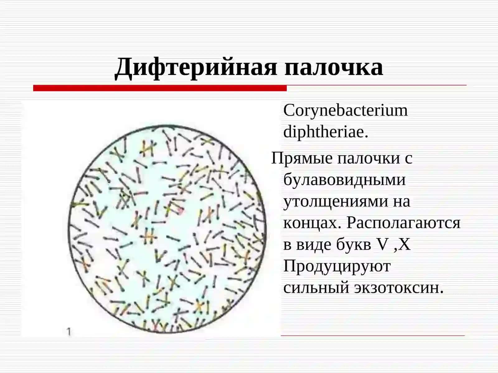ДИФТЕРИЯ 3