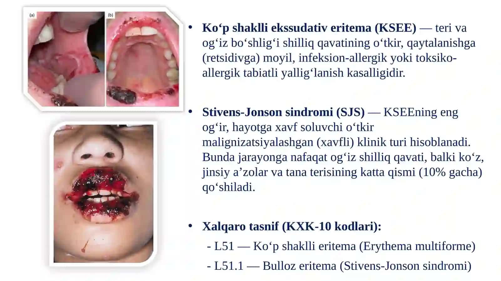 Bolalarda Og‘iz Bo‘shlig‘i Shilliq Qavatida Ko‘p Belgili Ekssudatli Eritemani 3