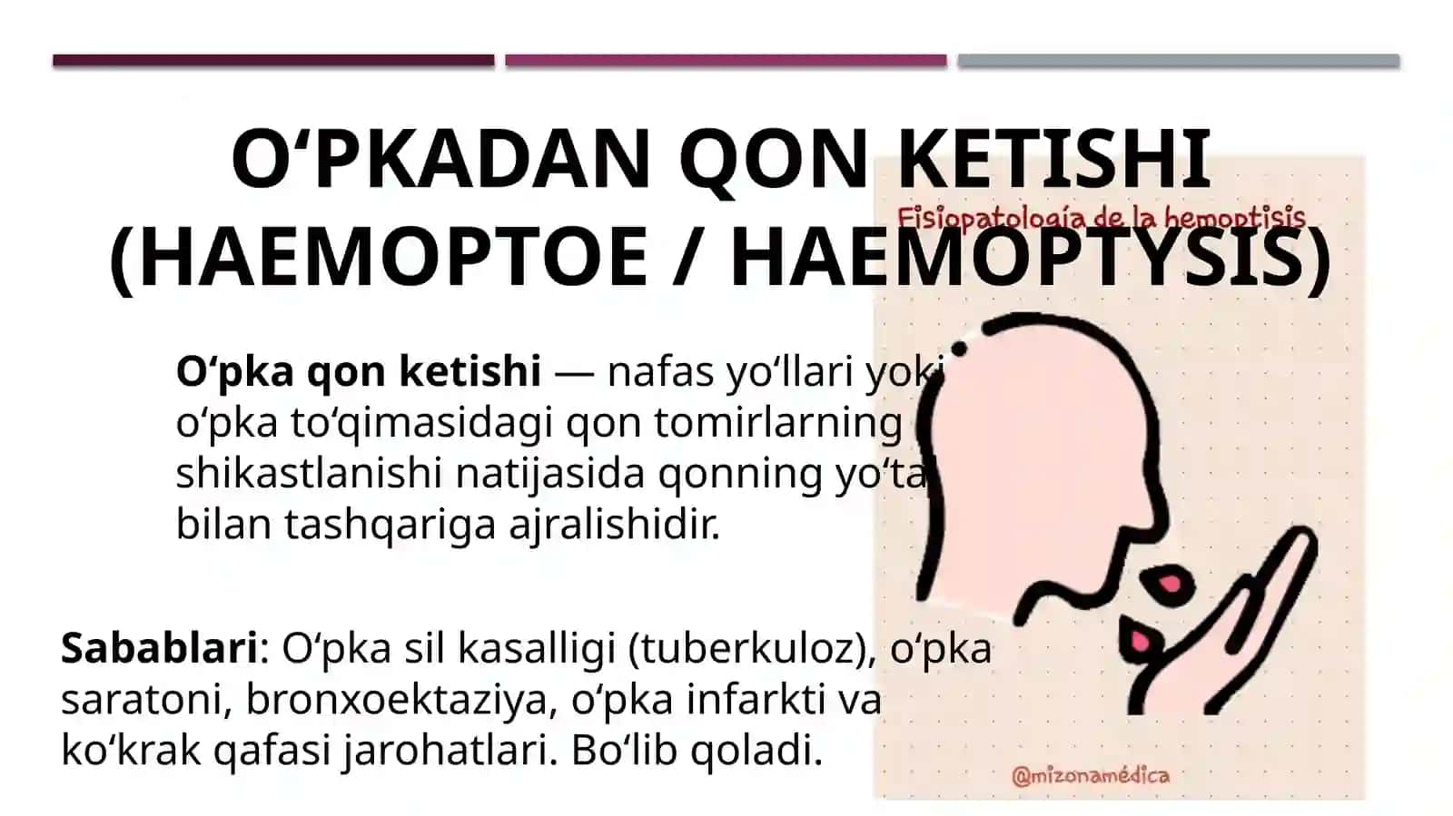 O‘PKADAN QON KETISHI (HAEMOPTOE / HAEMOPTYSIS) 3