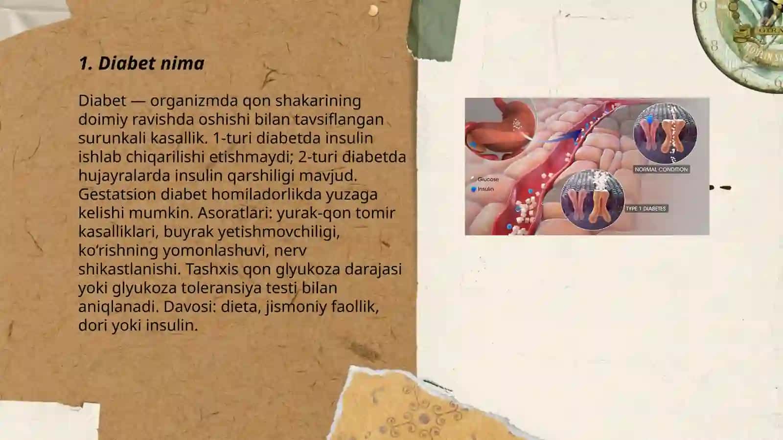 Diabet 3