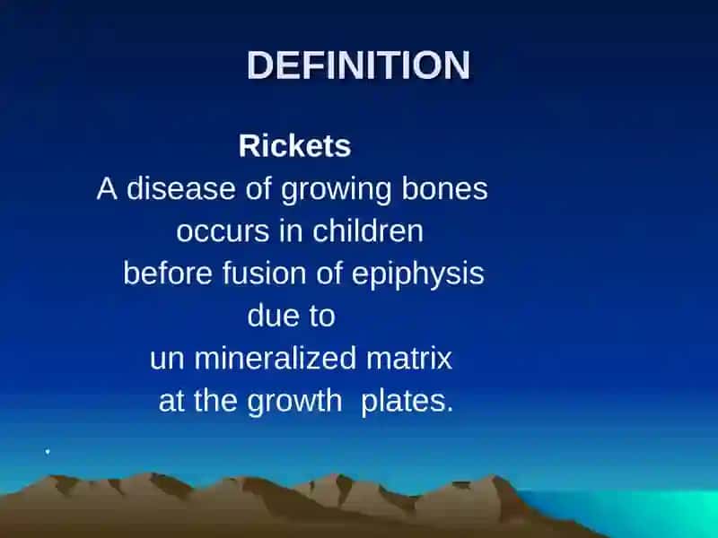 Rickets 3
