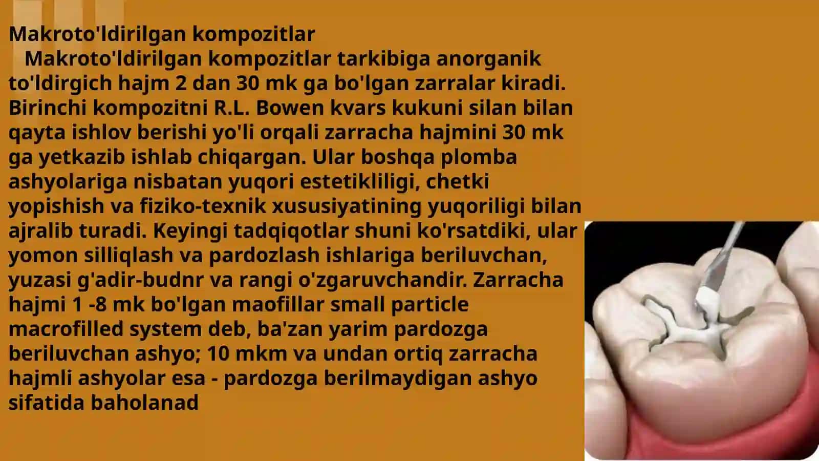 Kimyoviy va nur bilan qotuvchi kompozitlarning polimerizatsiya bosqichining oʻziga xos tomonlari 3
