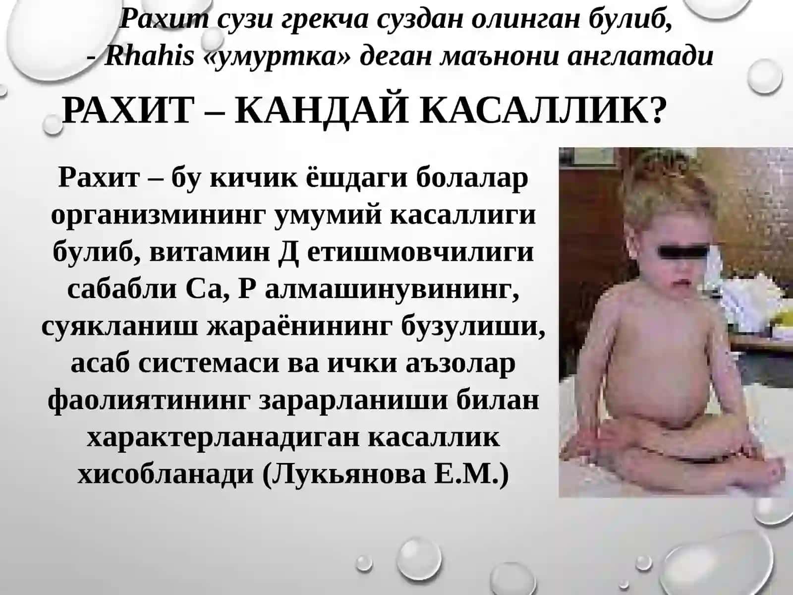 ЭРТА ЁШДАГИ БОЛАЛАРДАРАХИТ КАСАЛЛИГИ 3