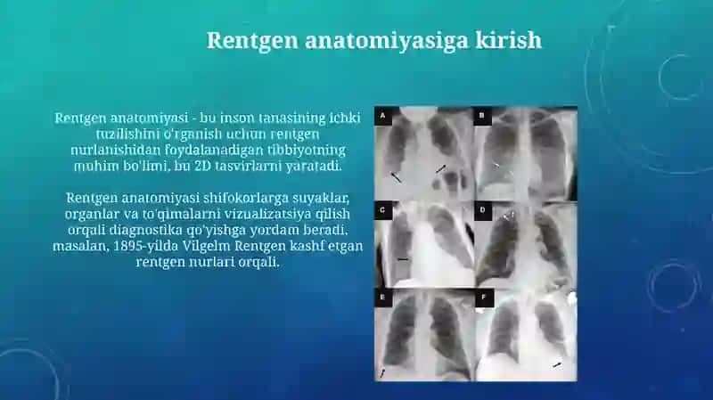 Hazm a'zolarining rentgenanatomiyasi va rivojlanish nuqsonlari 3