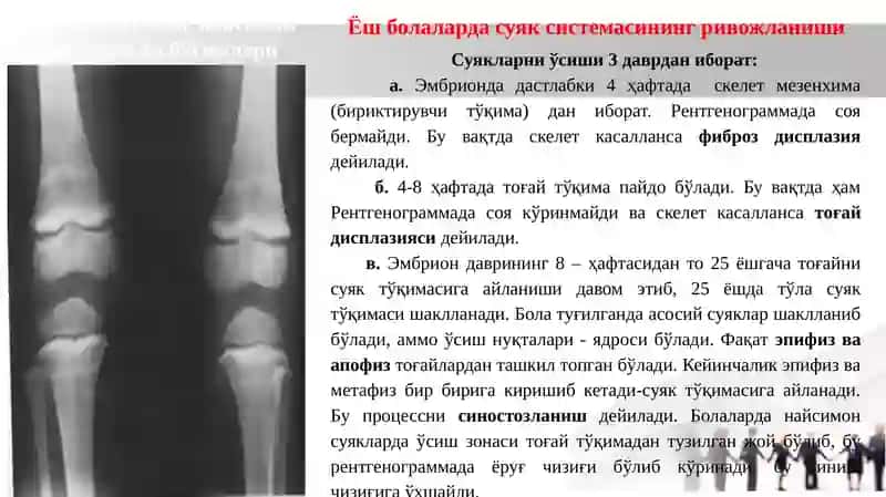 Мавзу: Суяк ва бўғимларнинг тараққий этиши, суяклар тузилиши таркиби ва рентгеноанатомияси 3