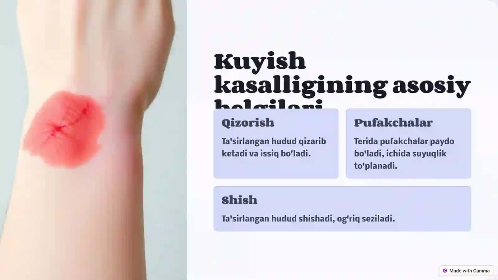 Xirurgiyada Kuyish Kasalligi 3