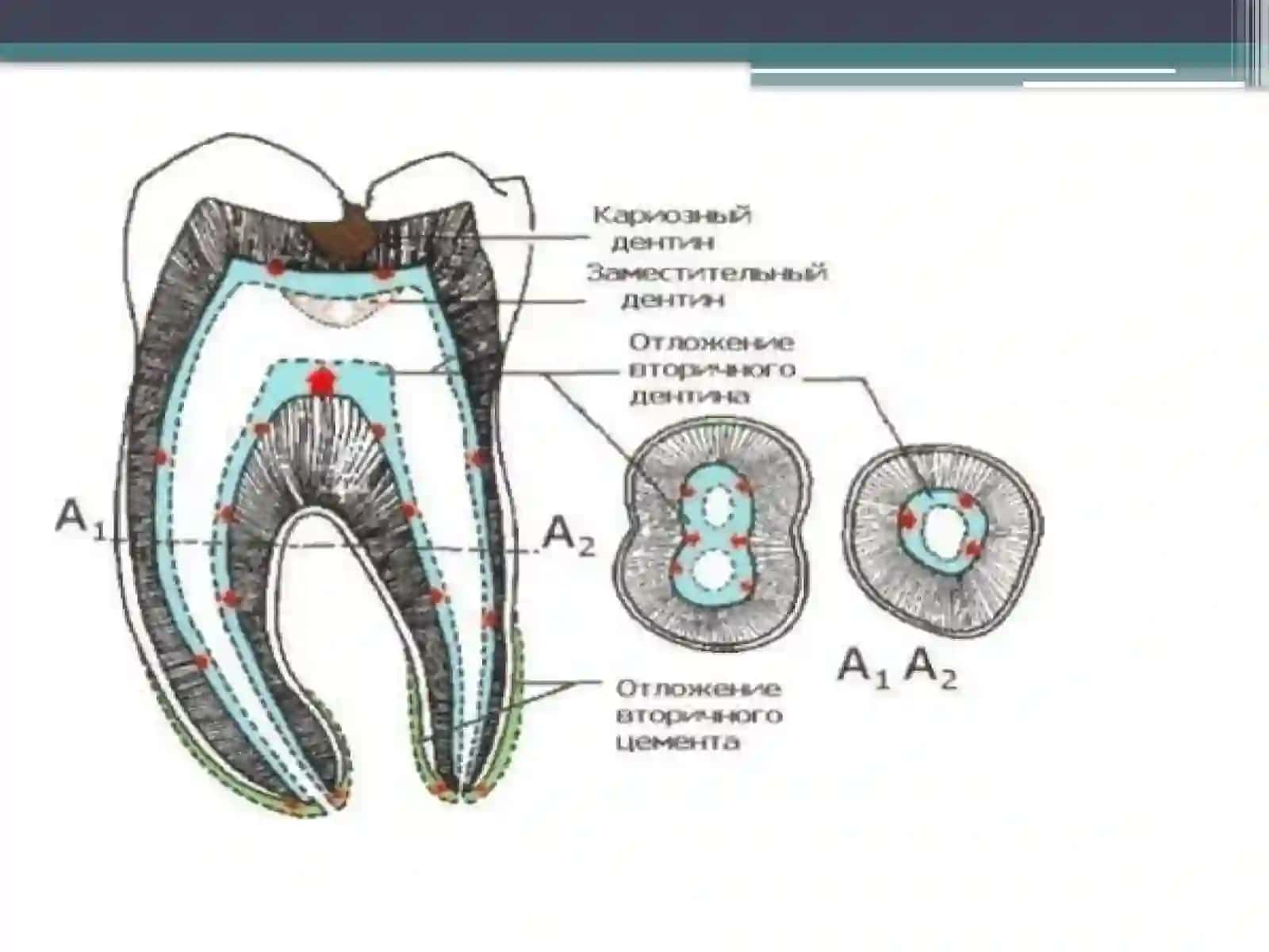 Pulpa to'qimasining mehanik va immunobiologik himoya vazifasi 3