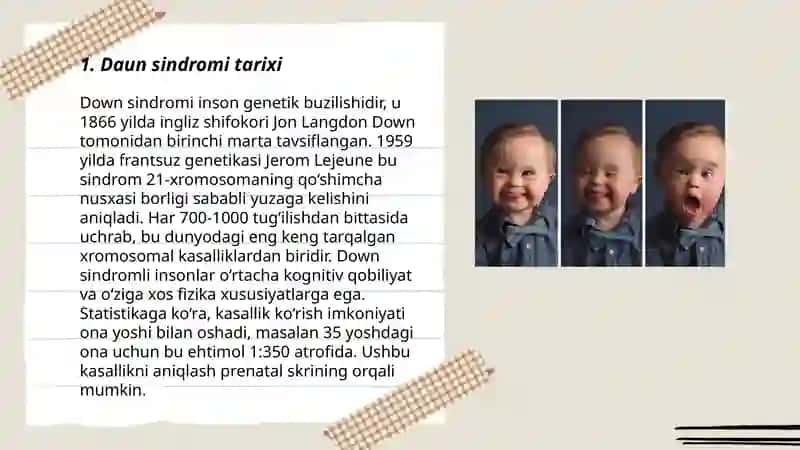 Down sindromi tarixi 3
