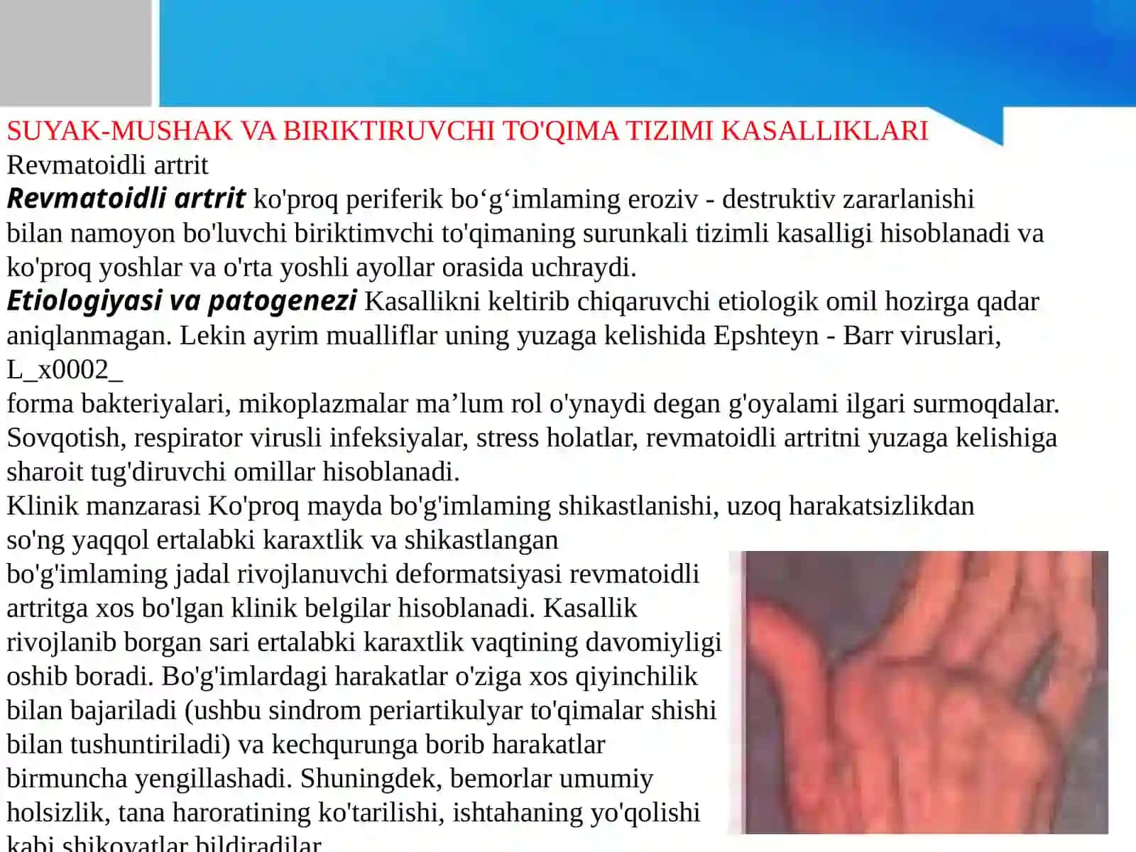 Suyak-mushak va biriktiruvchi to‘qima tizimi 3