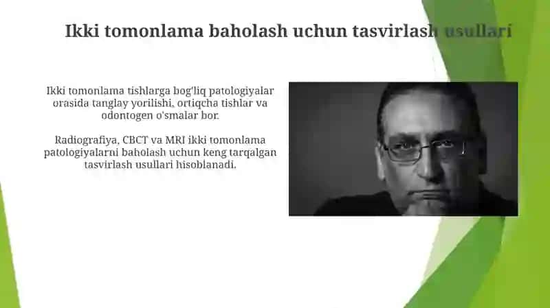 Dubletlar va uning patalogiyasi 3