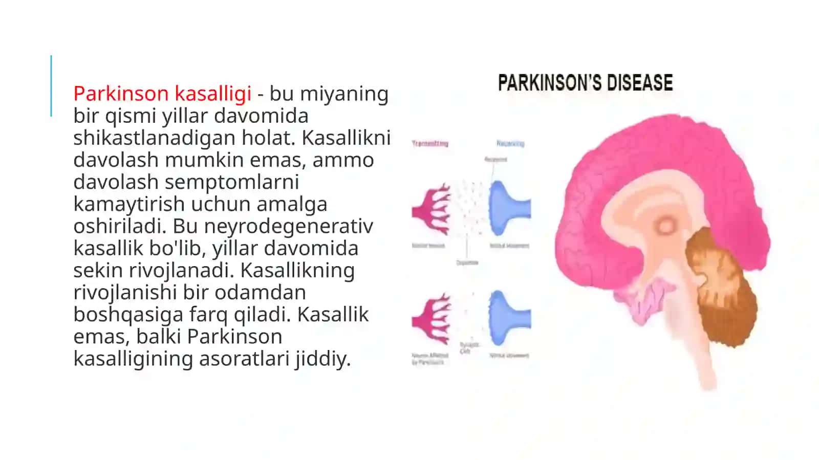Parkinson kasalligini davolash 3