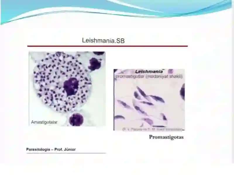 LEYISHMANIOZ 3