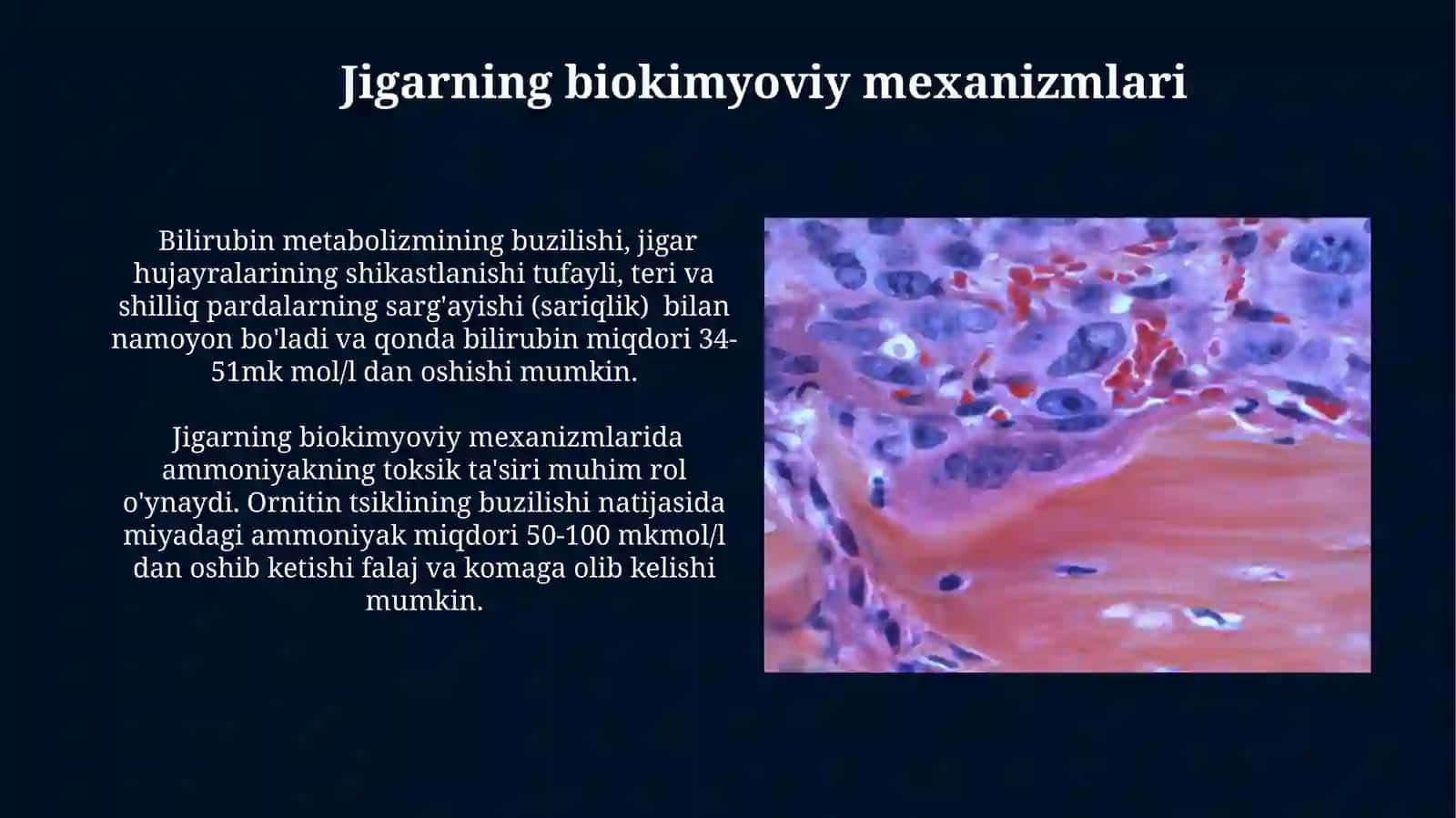 Jigar hujayra yetishmovchiligi va jigar komasi vujudga kelishining biokimyoviy mexanizmlari 3