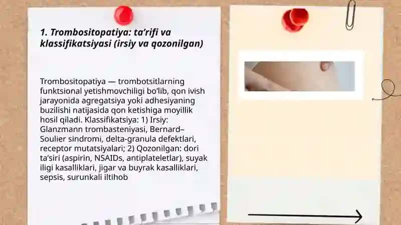 Trombositopatiya 3