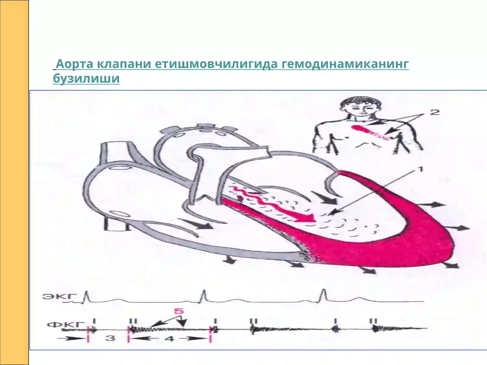 Аортал пороклар 3