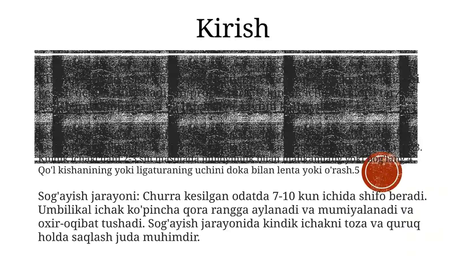 Bolalarda Churra Kesish Texnikasi 3