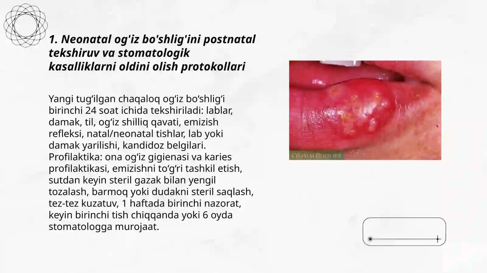 Neonatal og'iz bo'shlig'ini postnatal tekshiruv va stomatologik kasalliklarni oldini olish protokollari 3