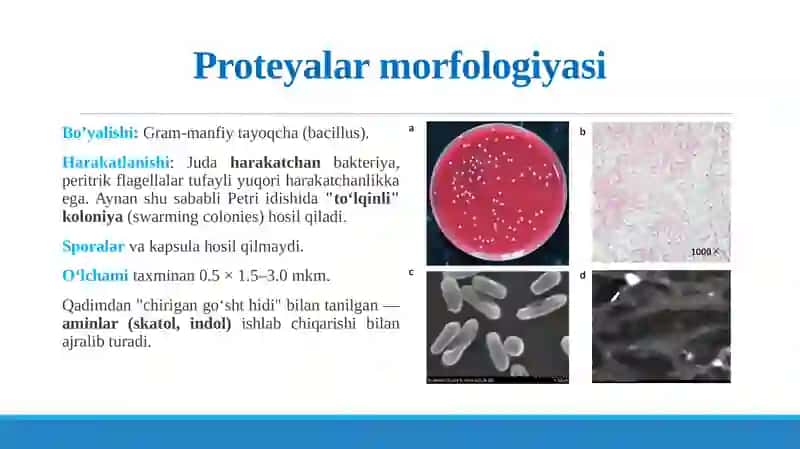TMI-8.Ovqatdan zaharlanish kasalliklari 3