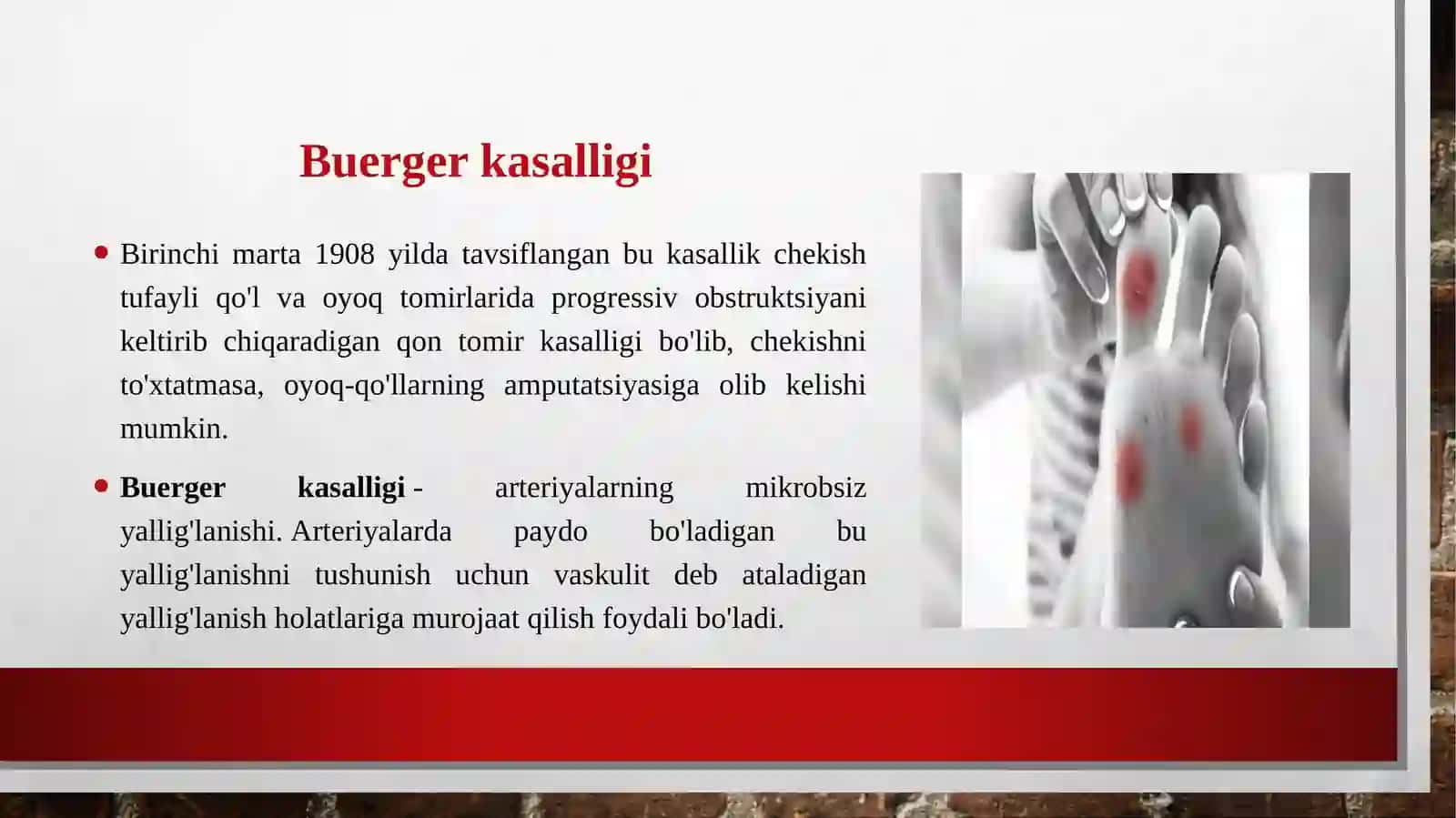 Buerger kasalligihaqidatushuncha 3