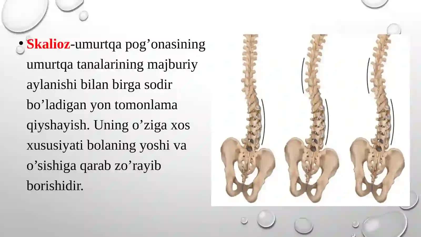 Skalioz 3