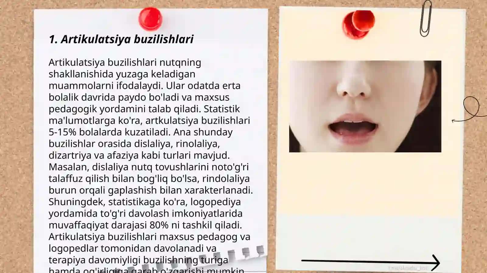 Artikulatsiya buzilishlari 3