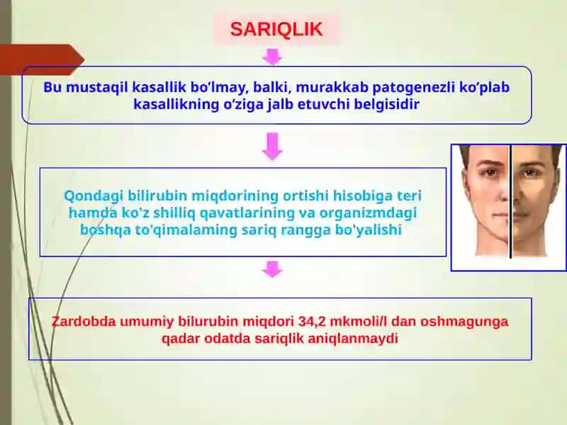 Sariqlik 3