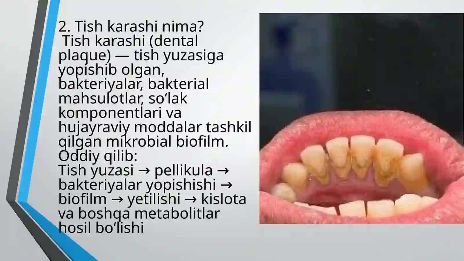 Stomatologik gigiyena 3