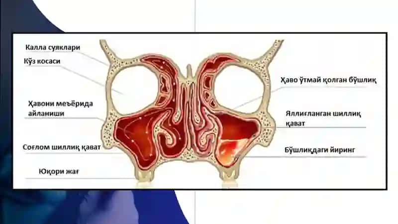 ODONTOGEN GAYMORIT 3