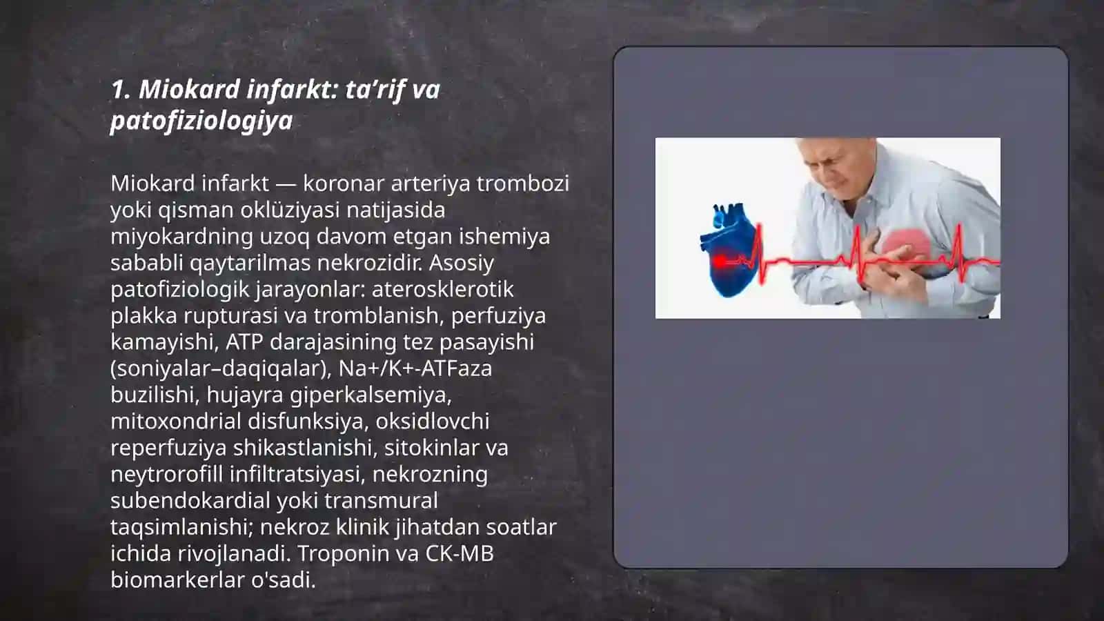 Miokard infarkt 3