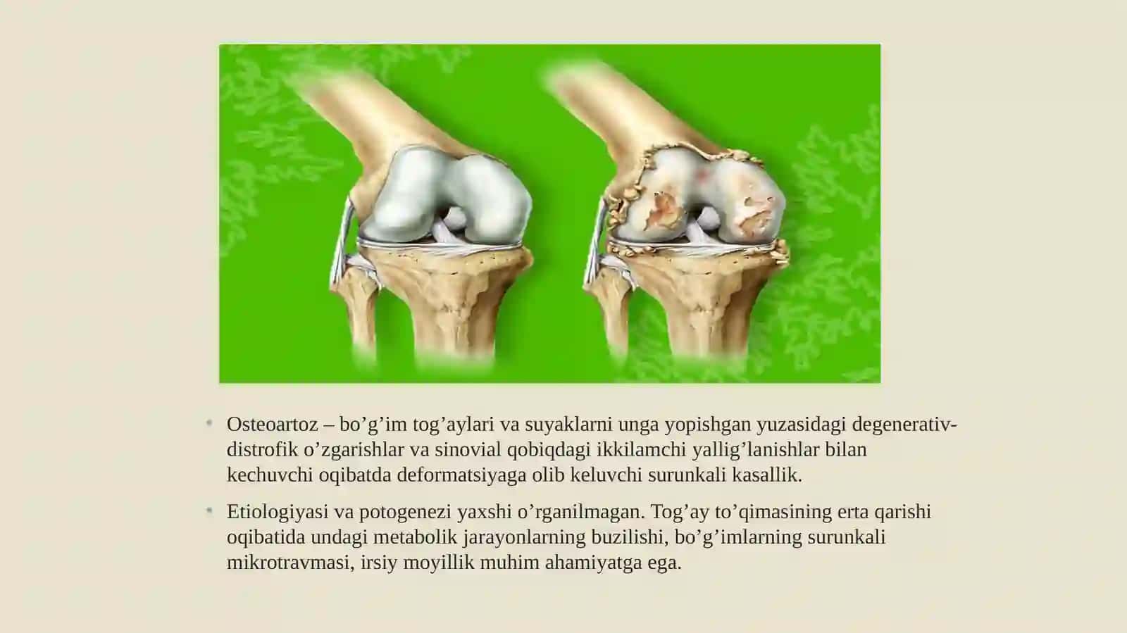Ikp fanidan “suyak-mushak va biriktiruvchi to’qima kasalliklari” 3