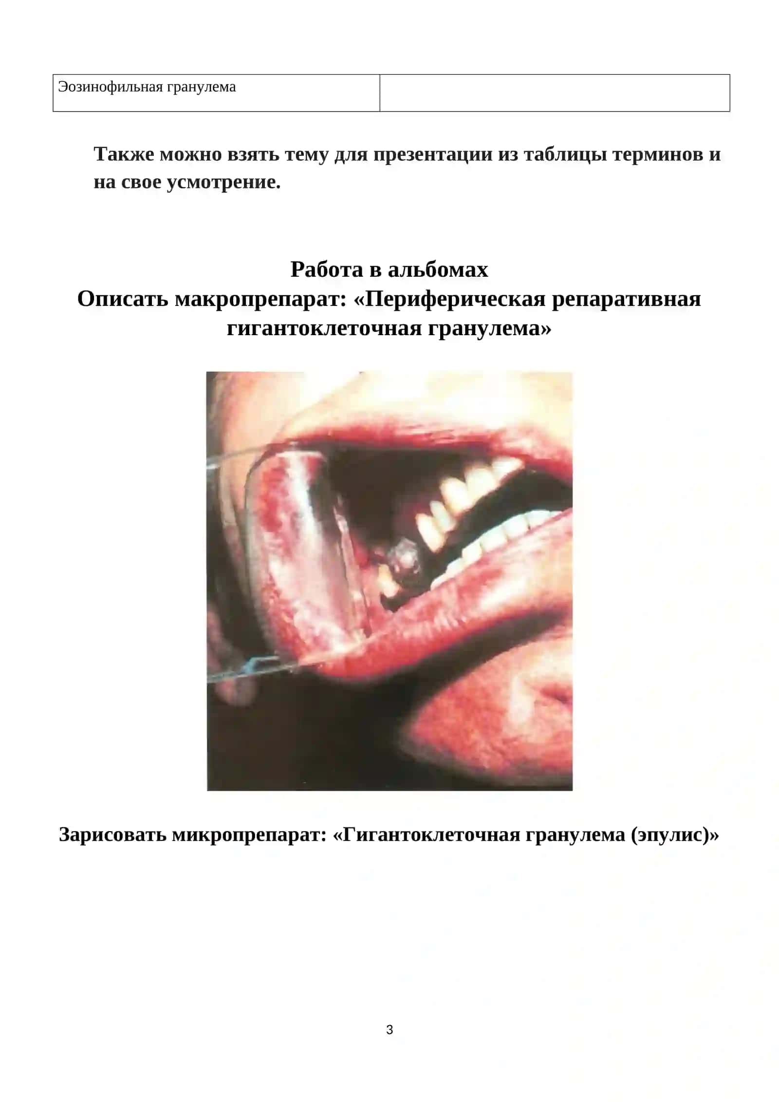 Опухолеподобные заболевания зубов 3