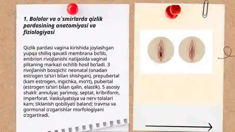 Bolalar va o`smirlarda qizlik pardasining anatomiyasi va fiziologiyasi 3