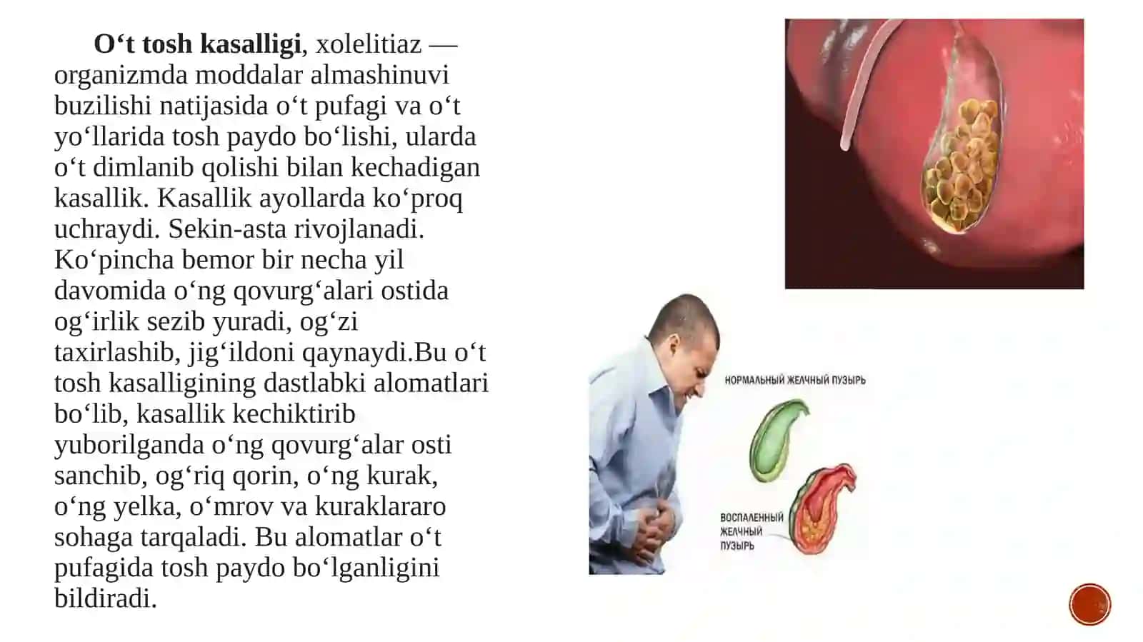Oʻttoshkasalligi 3