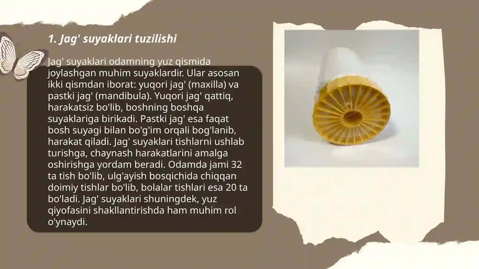 Yuqori va pastki jagʻ suyaklari 3