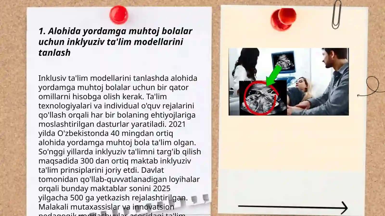 Alohida yordamga muhtoj bolalarda rivojlanishdagi nuqsonining chuqurligi va tuzilishiga qarab inklyuziya modellarini tanlash 3