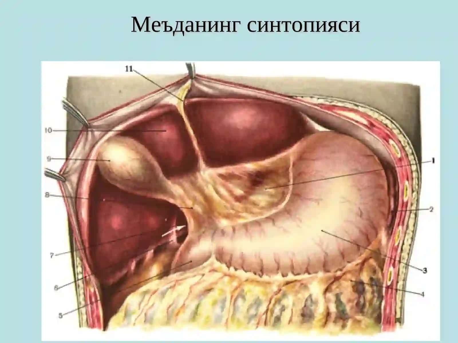 МЕЪДА ВА 12 БАРМОҚЛИ ИЧАК ЯРА КАСАЛЛИГИ 3