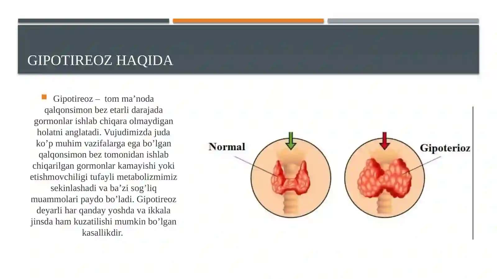 Endemik buqoq va gipotireoz patogenezi va davolash usullari 3