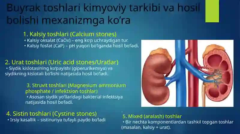Buyraklarda urat toshlarini hosil bo‘lishi va davolash yo‘llari.Orotatsiduriya, uning sabablari va uridin bilan davolash mexanizmi 3