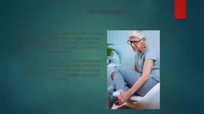Artrogripoz 3