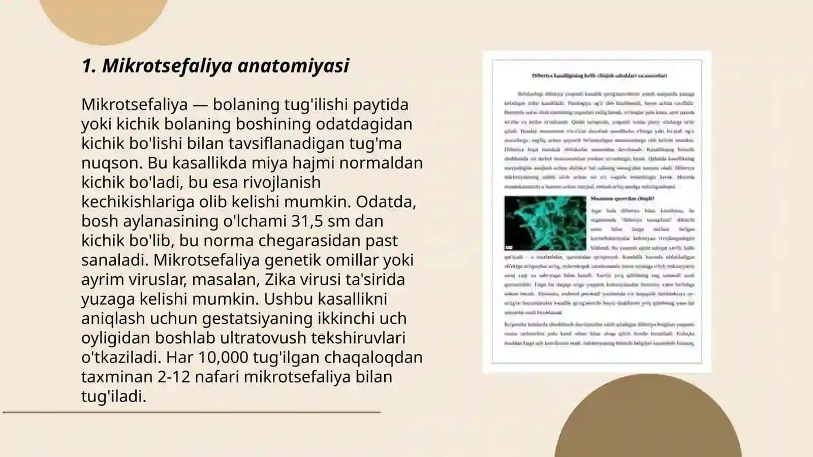 Mikrotsefaliyaning kelib chiqish sabablari va asoratlari 3