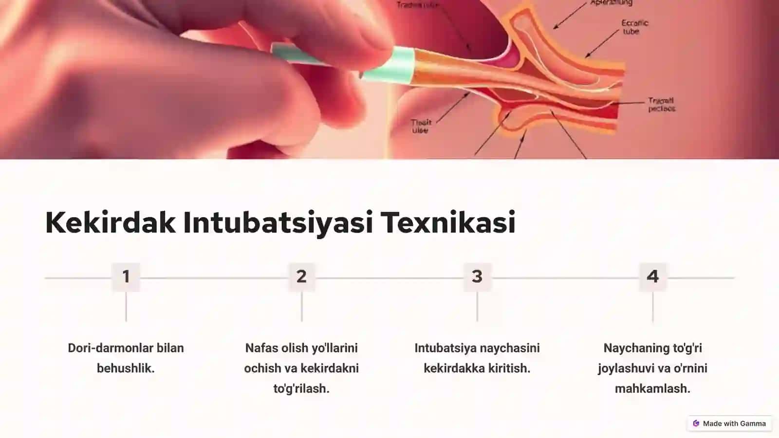 Kekirdak Intubatsiyasi va Traxeobronxoskopiya 3