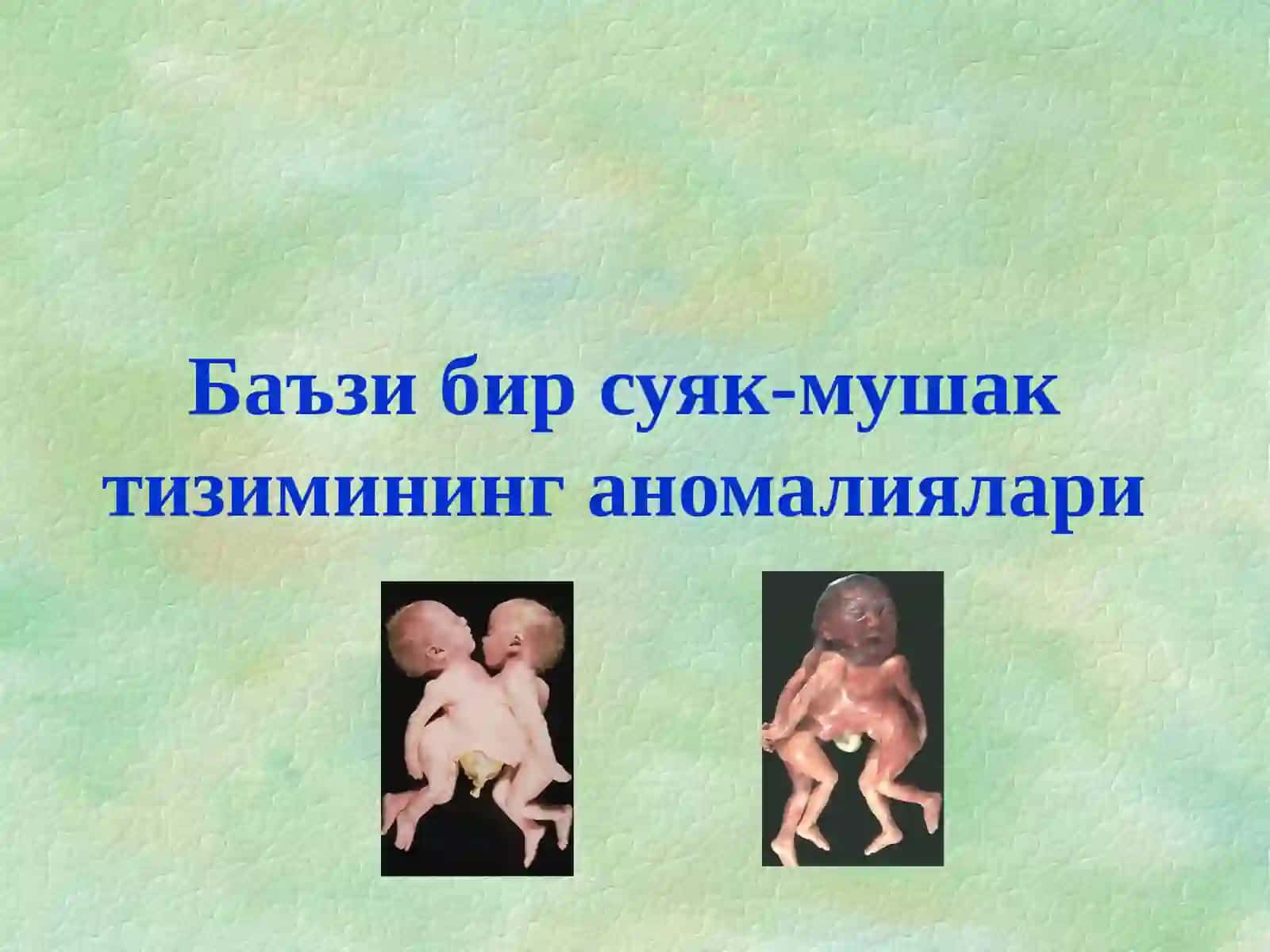 Туғма оёқ-қўл нуқсонлари 3