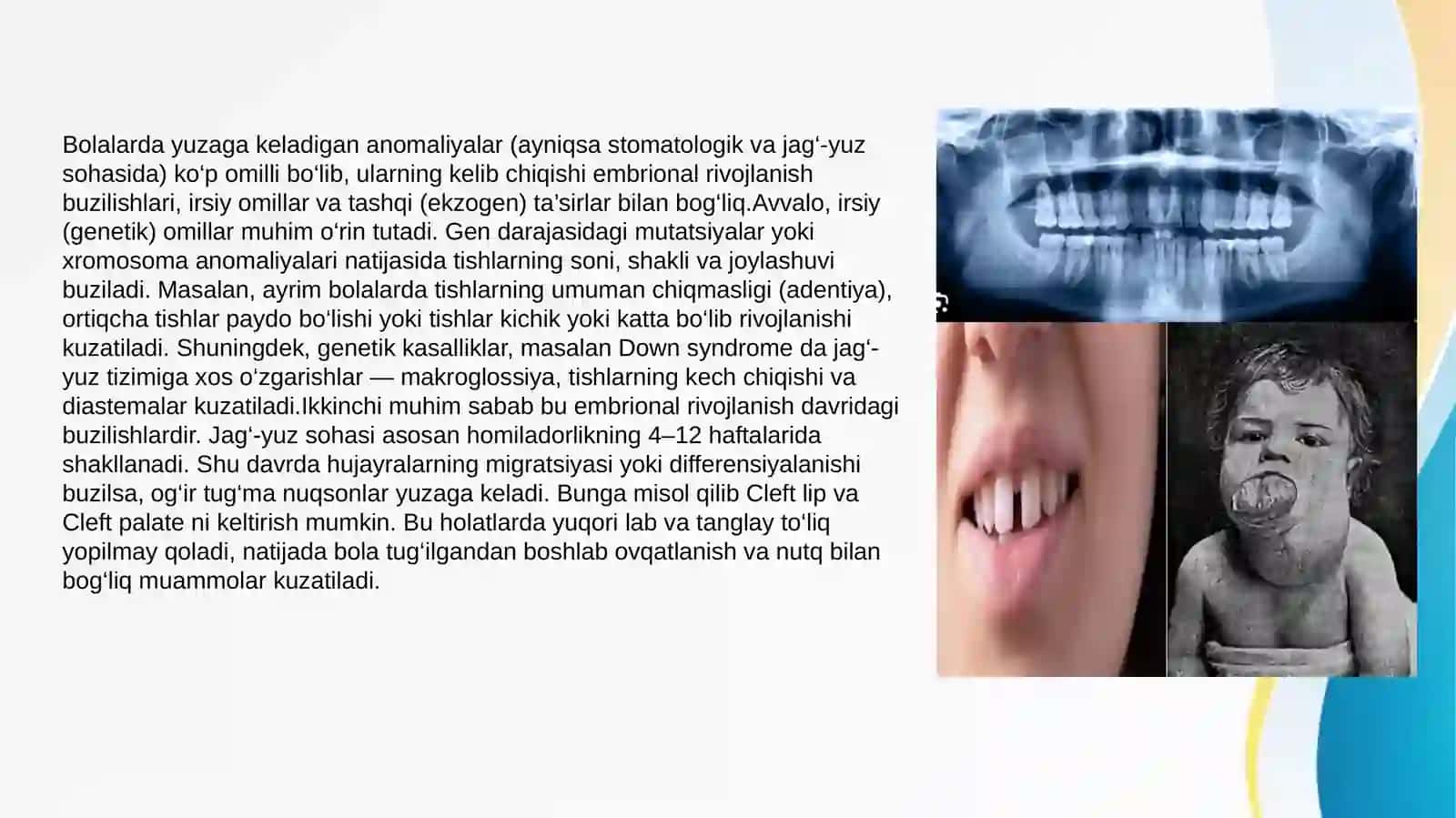 Bolalar stomatologiyasidsa anomaliya va deformatsiyalar rivojlanishi 3