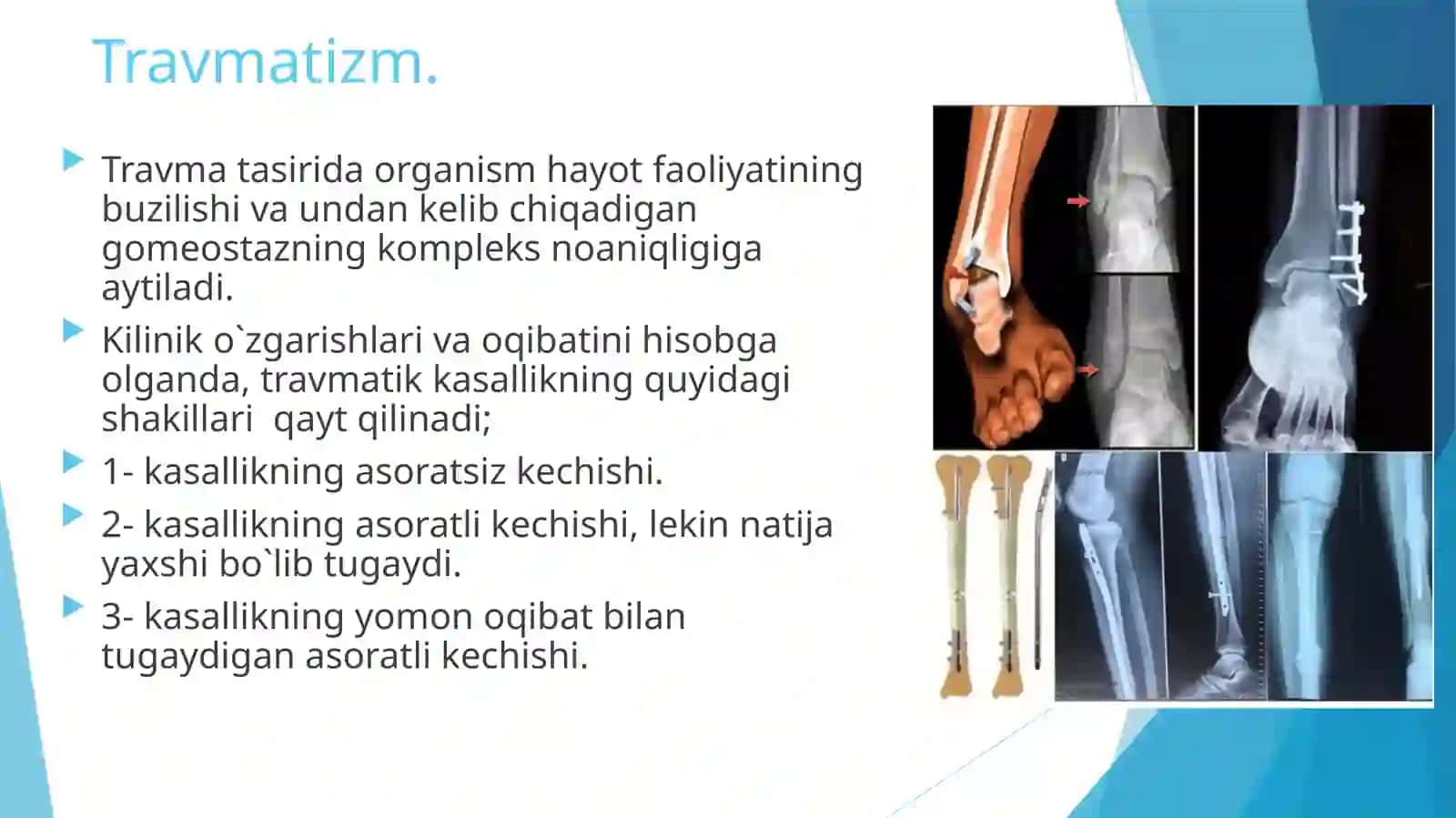 shikastlanish, travmatizm klasifikatsiyasi 3