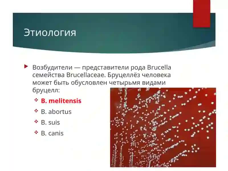 Бруцеллёз 3