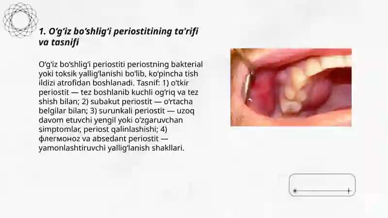O‘g‘iz bo‘shlig‘ining yiringli yallig‘lanish kasalliklari (periostit) 3