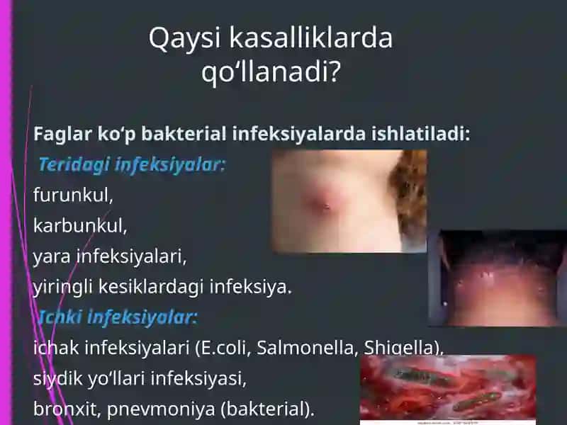 Bakteriofaglarni amaliyotda (davolashda, identifikatsiyada, profilaktikada) qoʻlanilishi 3